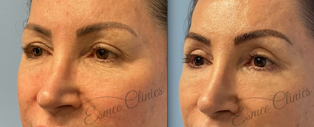 Before and After img